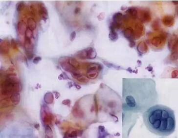 ���(l��i)ϴ���ӣ��������ךW���M(j��n)�ھ�ϴ�O���ꑌ�������Ҽ�